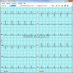 Logiciel M-Base pour transfert ECG éolys®