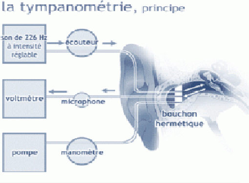 Tympanométrie